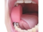 Preview: "Mouth Prop" Beissblock mit Zungenhalter, Größe SS