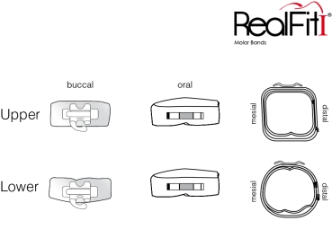RealFit™ I - Intro-Kit, OK, Einfach-Kombination (Zahn 17, 16, 26, 27) Roth .022"