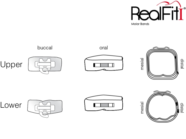 RealFit™ I - Intro-Kit, OK, Zweifach-Kombination + pal. Schloß (Zahn 17, 16, 26, 27) MBT* .018"
